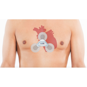 Miniholter ECG Time S a jeho umístění na těle