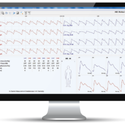 Monitor a výsledné křivky přístroje AngE Phlebo